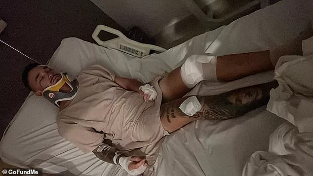 The young Australian man has suffered a broken femur, bleeding on the brain and a potentially fractured back and is recovering in BIMC Hospital in Kuta